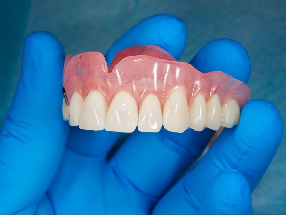 prothèse dentaire complète