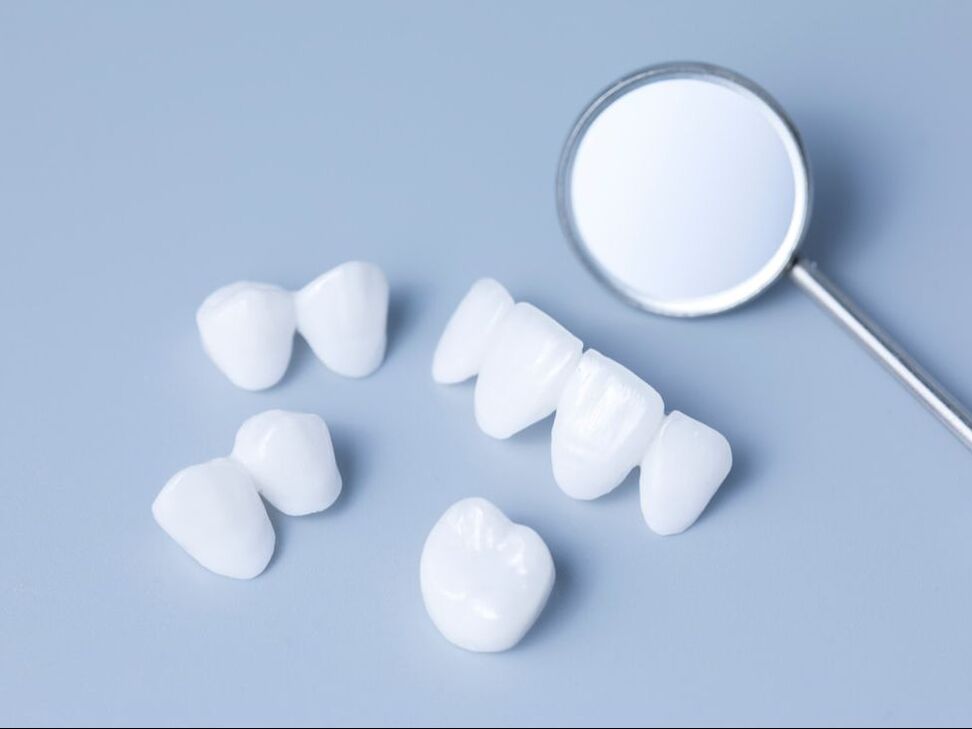 réhabilitement dentaire, traitement variée et complet