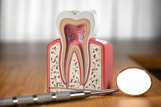 traitement de canal : endodontie